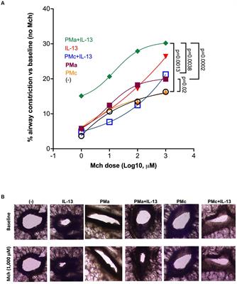 Desert particulate matter from Afghanistan increases airway obstruction in human distal lungs exposed to type 2 cytokine IL-13